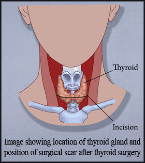 thyroid gland